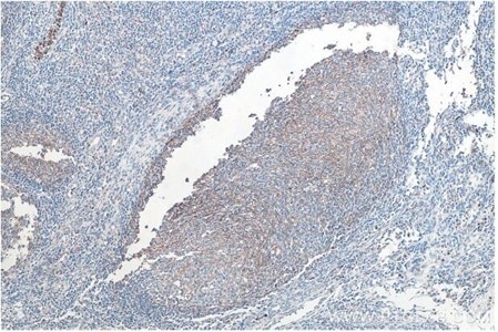 CD11B IHCキットを使用したパラフィン包埋ヒト扁桃炎組織の免疫組織化学染色