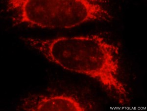 GLB1抗体およびRhodamine-labeled goat anti-rabbit IgGを用いたHeLa細胞の免疫蛍光染色