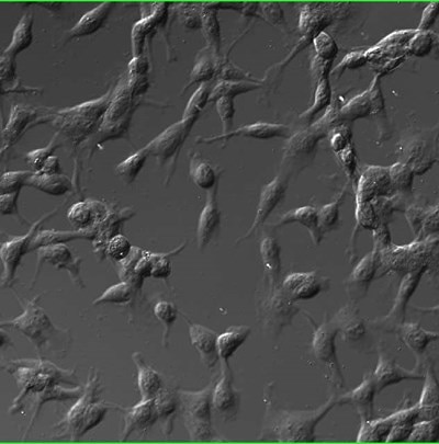 蛍光ナノダイヤモンドを取り込んだ大腸癌細胞の顕微鏡画像