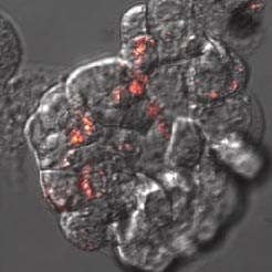 A：ナノダイヤモンドを取り込んだ結腸癌細胞HT-29の顕微鏡画像（拡大画像・赤色の蛍光が観察される）