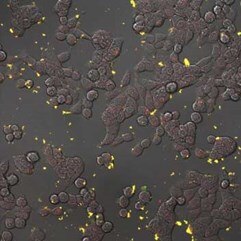 B：ナノダイヤモンドを取り込んだ結腸癌細胞HT-29の顕微鏡画像（緑色・赤色の蛍光が観察される）