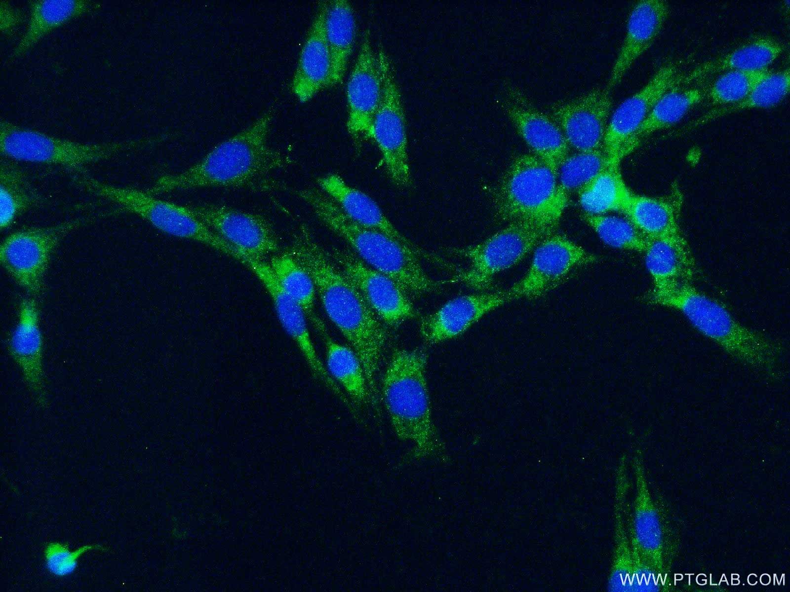 IBA1抗体、Alexa Fluor488標識AffiniPureヤギ抗ウサギIgG（H+L）抗体を使用したC6細胞（-20℃エタノール固定）の免疫蛍光染色