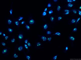 NIFK抗体を使用した核小体の免疫蛍光染色