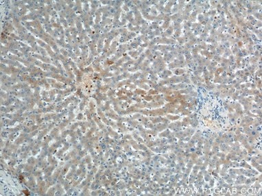 ポリクローナルULK1抗体を使用したヒト肝臓組織の免疫組織化学染色