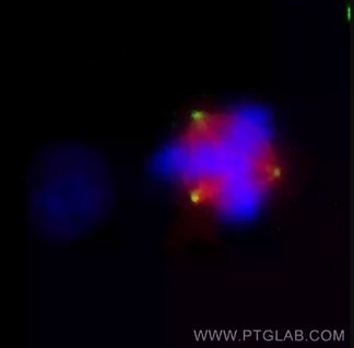 γチューブリン抗体を使用した中心体の免疫蛍光染色