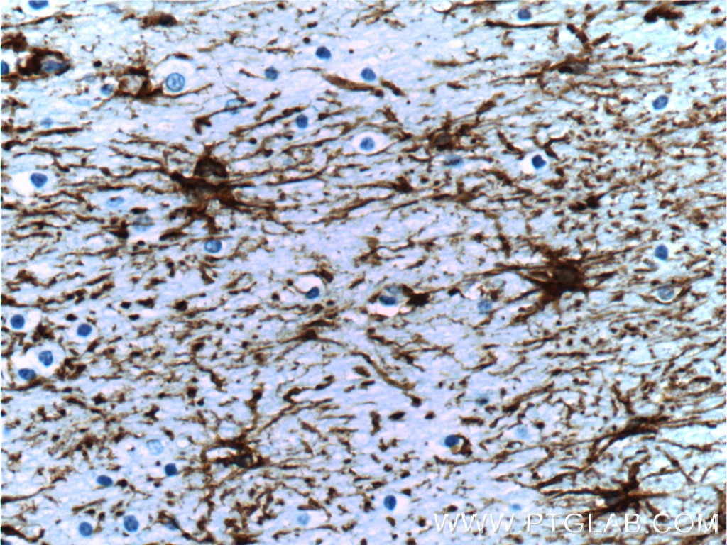 GFAP抗体を使用したパラフィン包埋ヒト脳組織の免疫組織化学染色