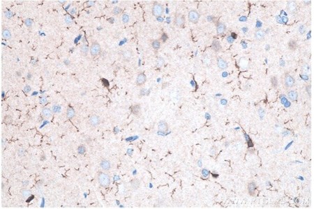 IBA1 IHCキットを使用したパラフィン包埋ラット脳組織の免疫組織化学染色