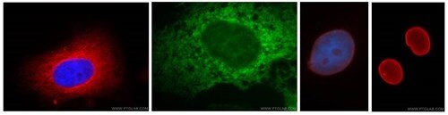 プロテインテック抗体を使用した様々な細胞小器官の免疫蛍光染色画像（4枚）