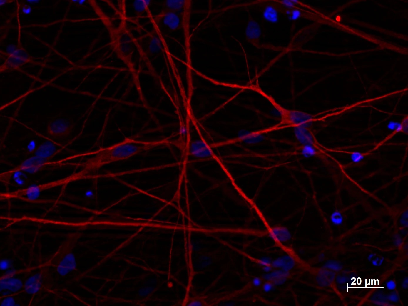 MAP2抗体を使用した、ヒトiPS細胞由来培養神経細胞（4%PFA固定、培養期間35日）の免疫蛍光染色
