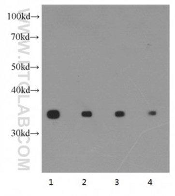 異なる濃度のGAPDH抗体を使用した様々なHeLa細胞のウェスタンブロット（希釈倍率によってシグナルの検出強度が変化）