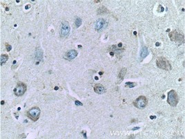 TAU抗体を使用したヒト脳組織の免疫組織化学染色