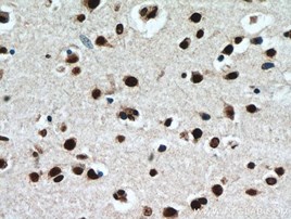TDP-43抗体を使用したヒト脳の免疫組織化学染色