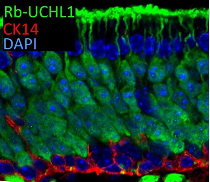 UCHL1抗体の免疫蛍光染色検証