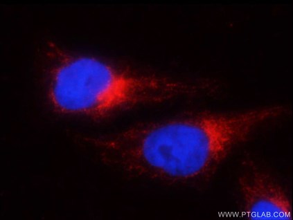 GRP78抗体の免疫蛍光染色検証