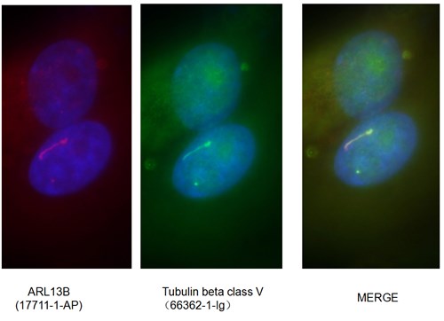 ARL13B 抗体とTubulin beta class V 抗体の免疫蛍光染色検証