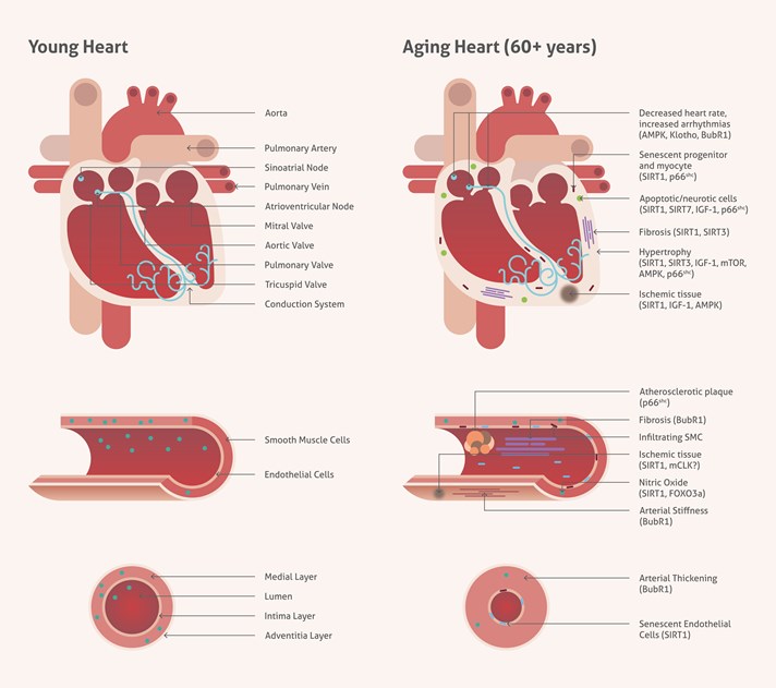 正常な心臓と老化心臓の比較図