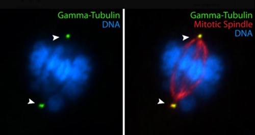 gamma-tubulin 抗体の免疫蛍光染色検証
