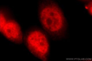 PKM1-Specific抗体の免疫蛍光染色検証