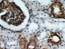 Stanniocalcin 2抗体の免疫組織化学染色検証