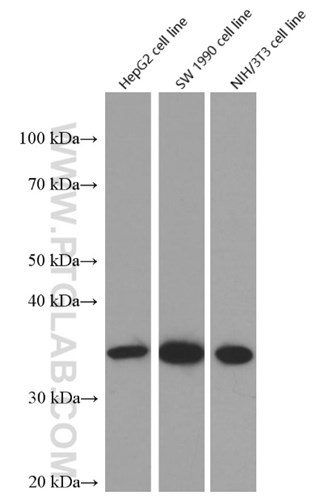 サイクリンD1抗体のウェスタンブロット検証