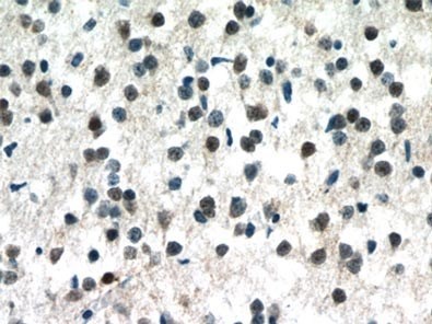 MECP2抗体を使用したパラフィン包埋ヒト脳組織スライドの免疫組織化学染色