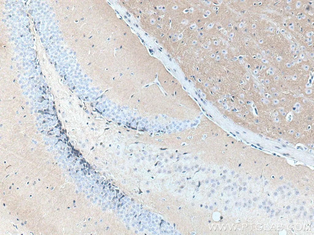 N-カドヘリン抗体を使用したマウス脳組織スライドの免疫蛍光染色。