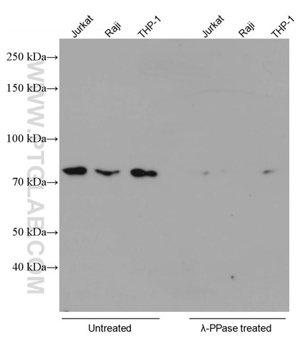 Phospho-RIPK1抗体を使用した種々の細胞ライセートのウェスタンブロット（未処理群はバンド検出、λプロテインホスファターゼ処理群はバンド消失）