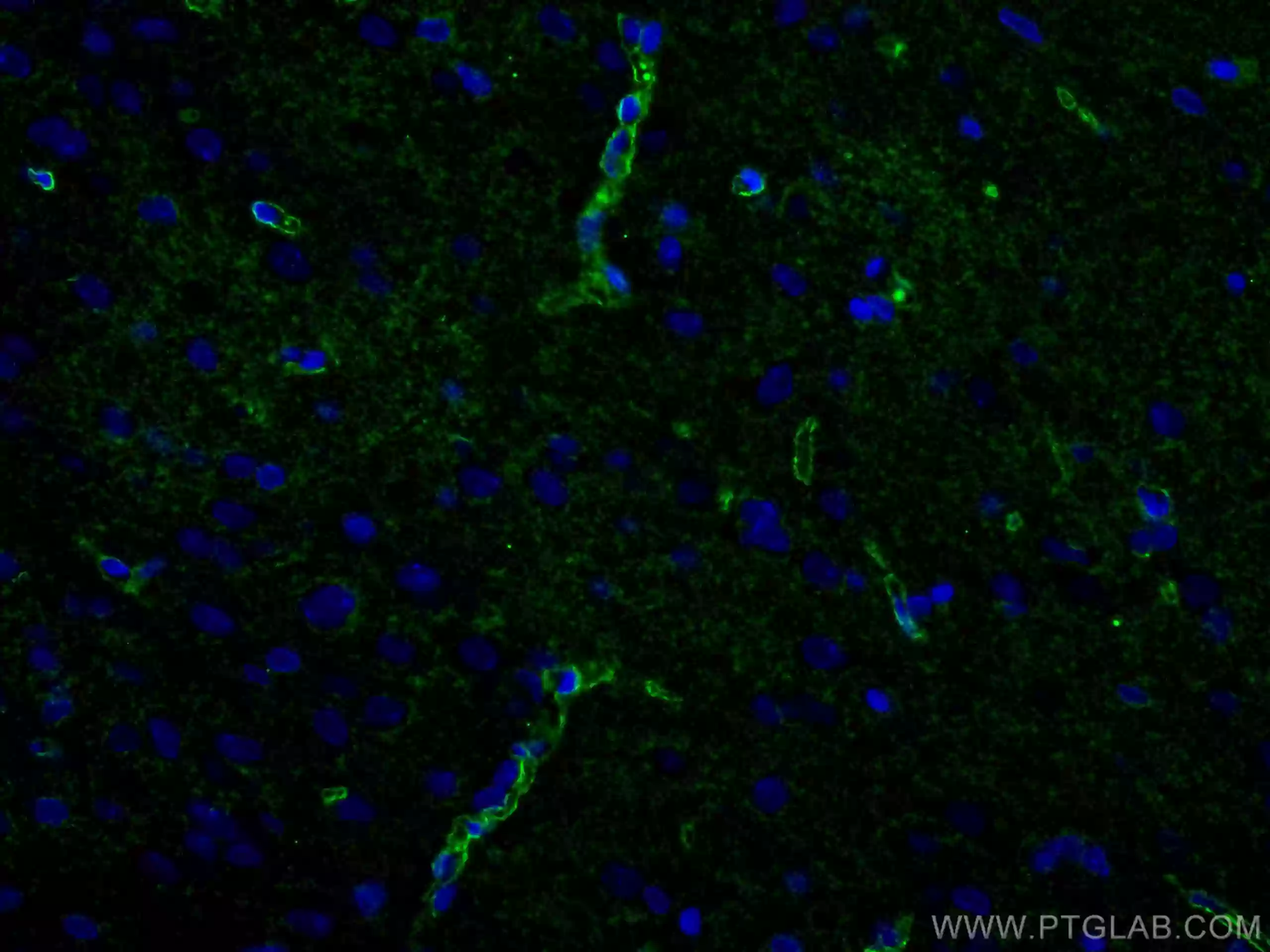 アクアポリン4抗体を使用した4% PFA固定ラット脳組織の免疫蛍光染色