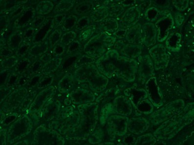 ホルマリン固定パラフィン包埋腎臓組織の自家蛍光画像（緑色フィルター）