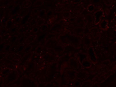 ホルマリン固定パラフィン包埋腎臓組織の自家蛍光画像（近赤外フィルター）