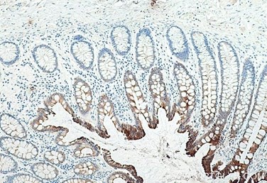 サイトケラチン19マウスモノクローナル抗体およびIHC前処理・発色キットを使用したヒト結腸組織の免疫組織化学染色