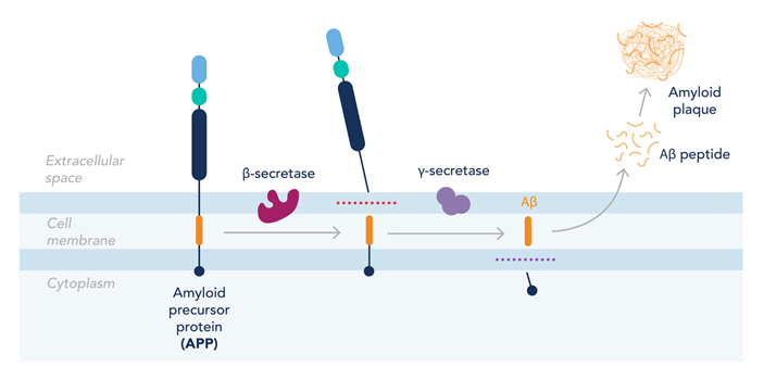 アルツハイマー病においてAPPがどのようにアミロイド斑の形成につながるかを詳細に示した図。