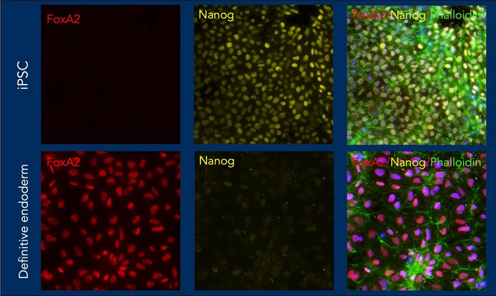 分化前（iPS）と分化後（内胚葉）の免疫蛍光染色の比較画像