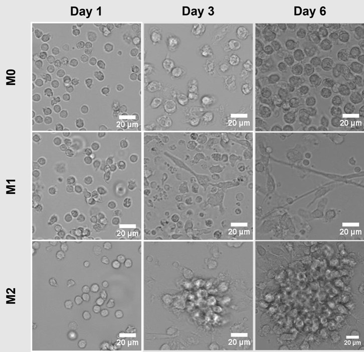M0・M1・M2マクロファージの培養画像