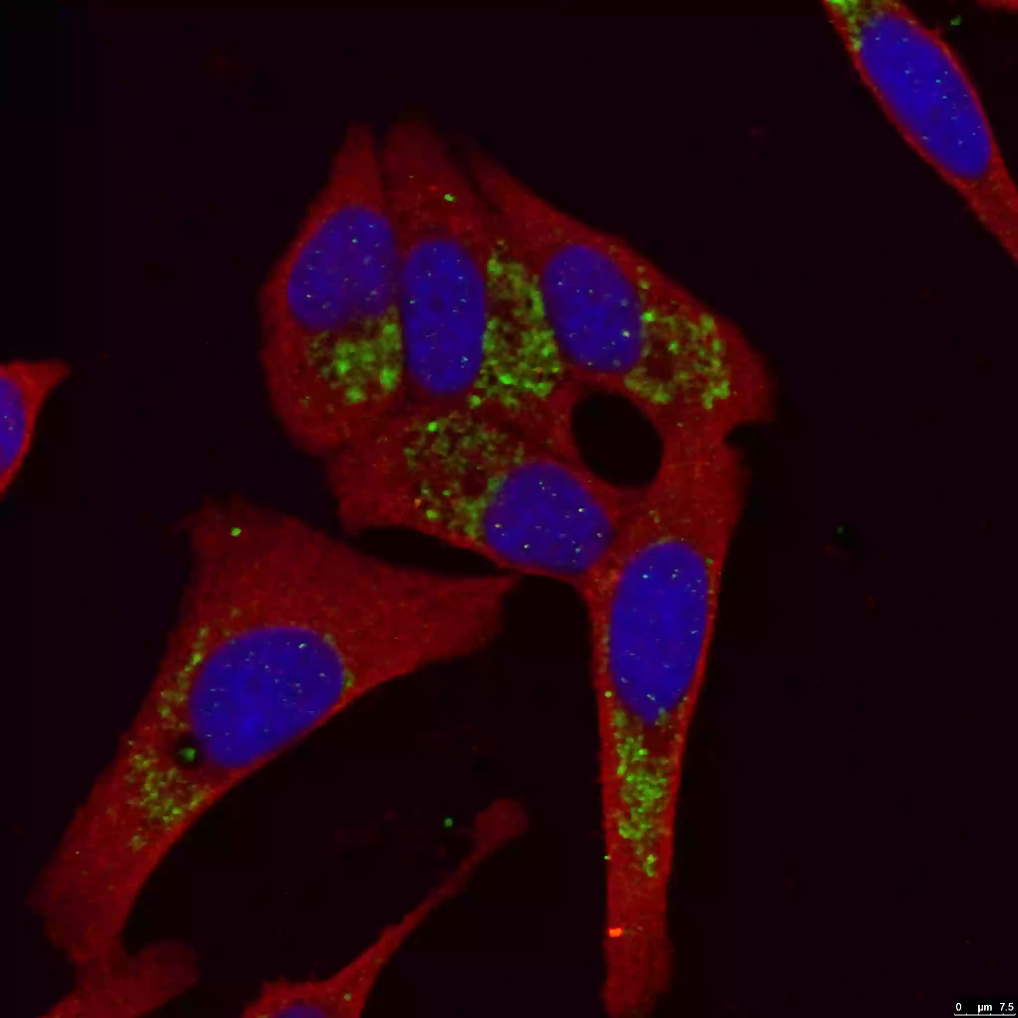 LC3B-Specific抗体をもちいたHepG2細胞の免疫蛍光染色像